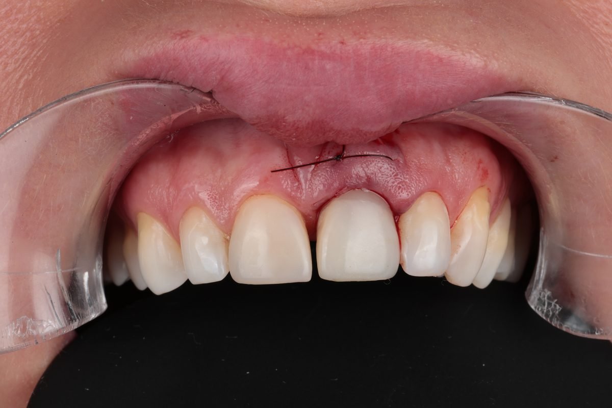 Clinical case after treatment